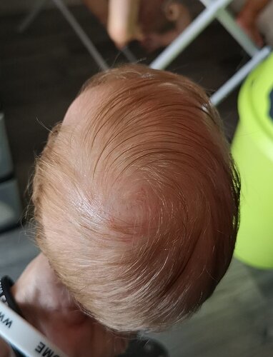 Tinkhairtop