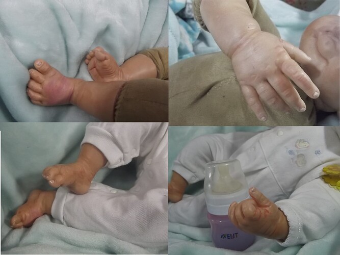 hands and feet