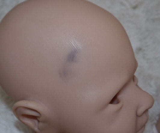 head-1-before