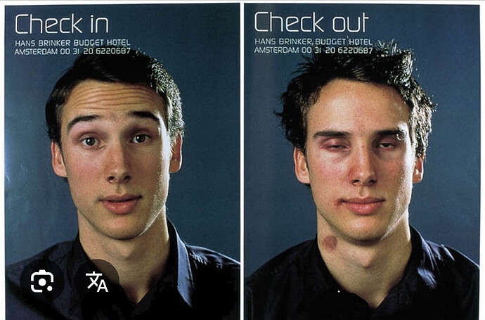 Zwei Bilder eines jungen Mannes, links "Check in" und rechts "Check out" betitelt. Das "Check in"-Bild zeigt ihn mit einem neutralen Gesichtsausdruck, während das "Check out"-Bild ihn mit geschwollenen Augen, roten Flecken im Gesicht und einem Knutschfleck am Hals zeigt.