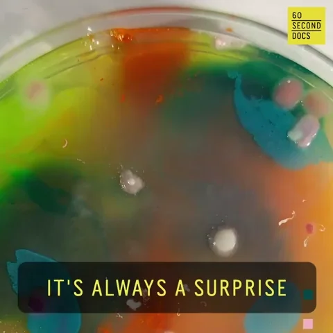 Surprise Mold GIF by 60 Second Docs