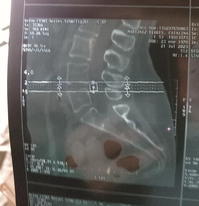 IMG_20230821_110548_edit_15598016778313