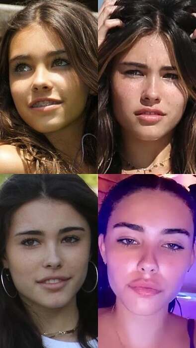madison-beer-hasnt-had-the-work-people-think-shes-had-done-v0-pcxzrbwk3u8d1