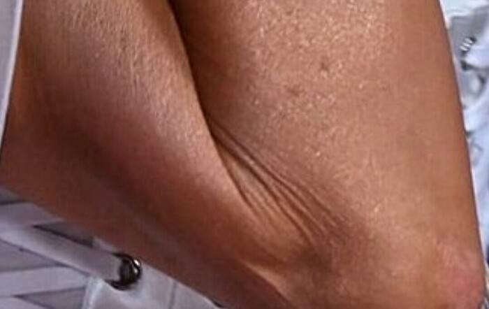 1000015975